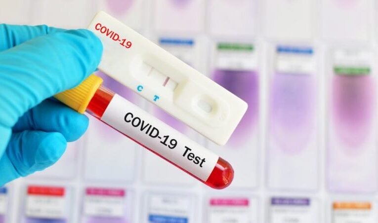 ΕΝΗΜΕΡΩΣΗ ΚΟΙΝΟΥ ΓΙΑ ΤΕΣΤ COVID-19