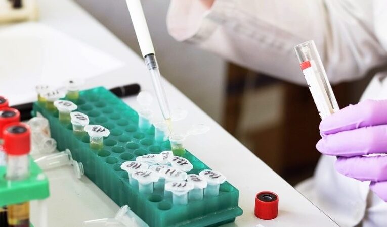 Αναστολή Κινητοποιήσεων Εργαστηριακών