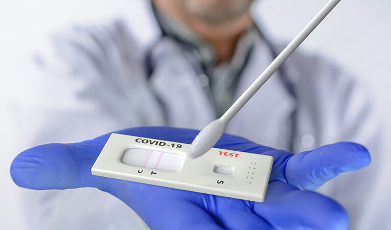 ΕΝΗΜΕΡΩΣΗ ΚΟΙΝΟΥ ΓΙΑ ΤΕΣΤ COVID-19